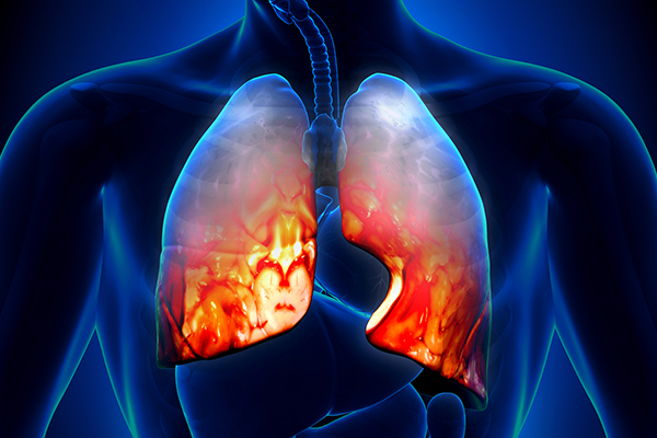 Are Respiratory Infections Contagious?