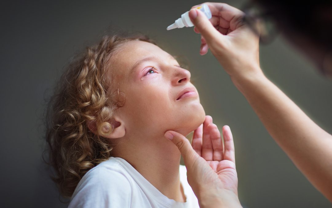 What is Conjunctivitis?