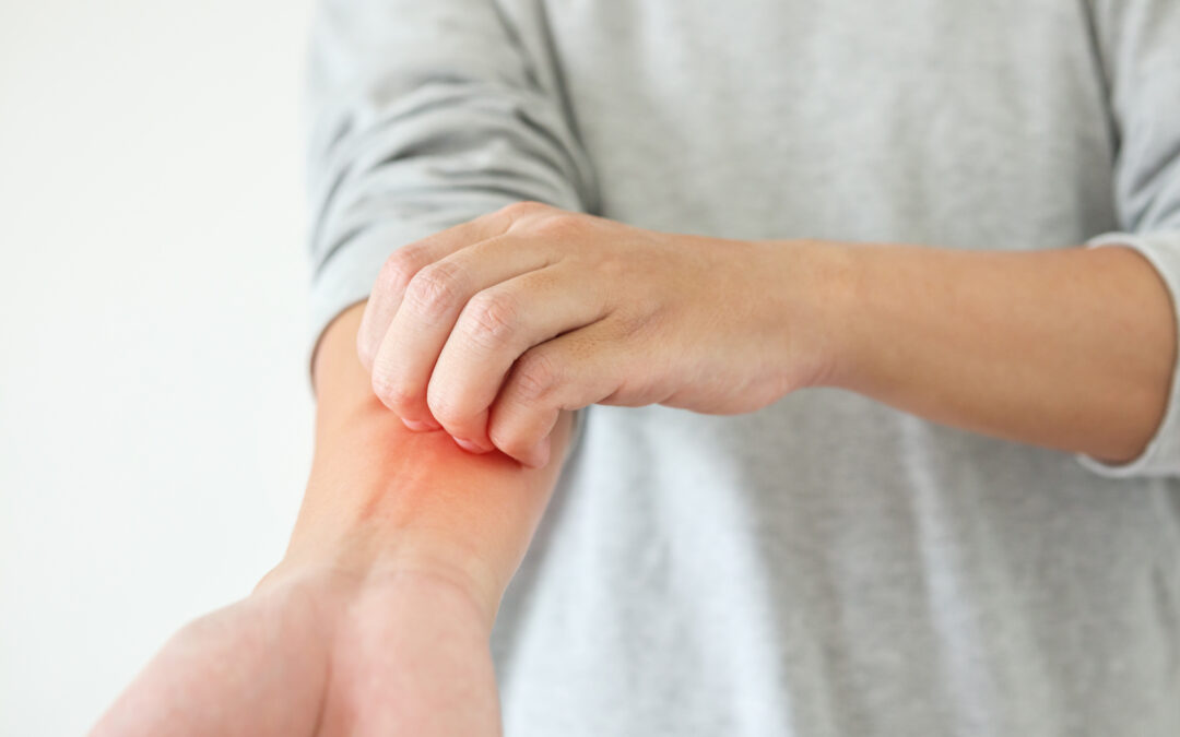 Dry, Scaly, or Tight Skin? What Could Be Causing It