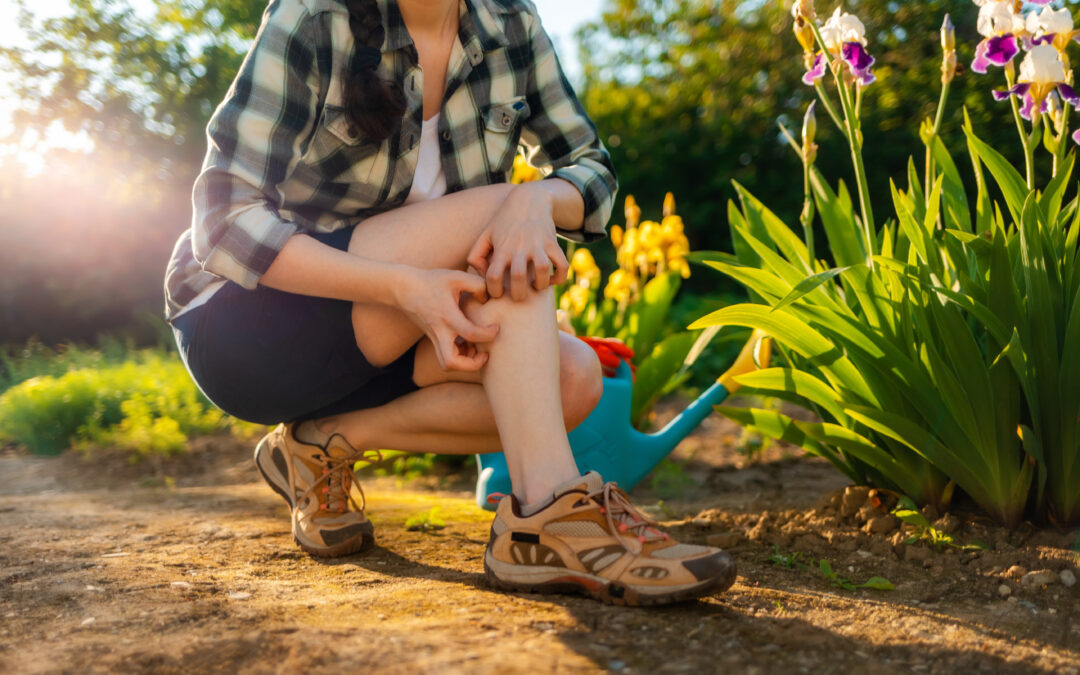 Summer season. Woman scratches her leg, which is itchy from a mosquito bite. Close up of legs. Outdoor. Allergies and insect bites concept.
